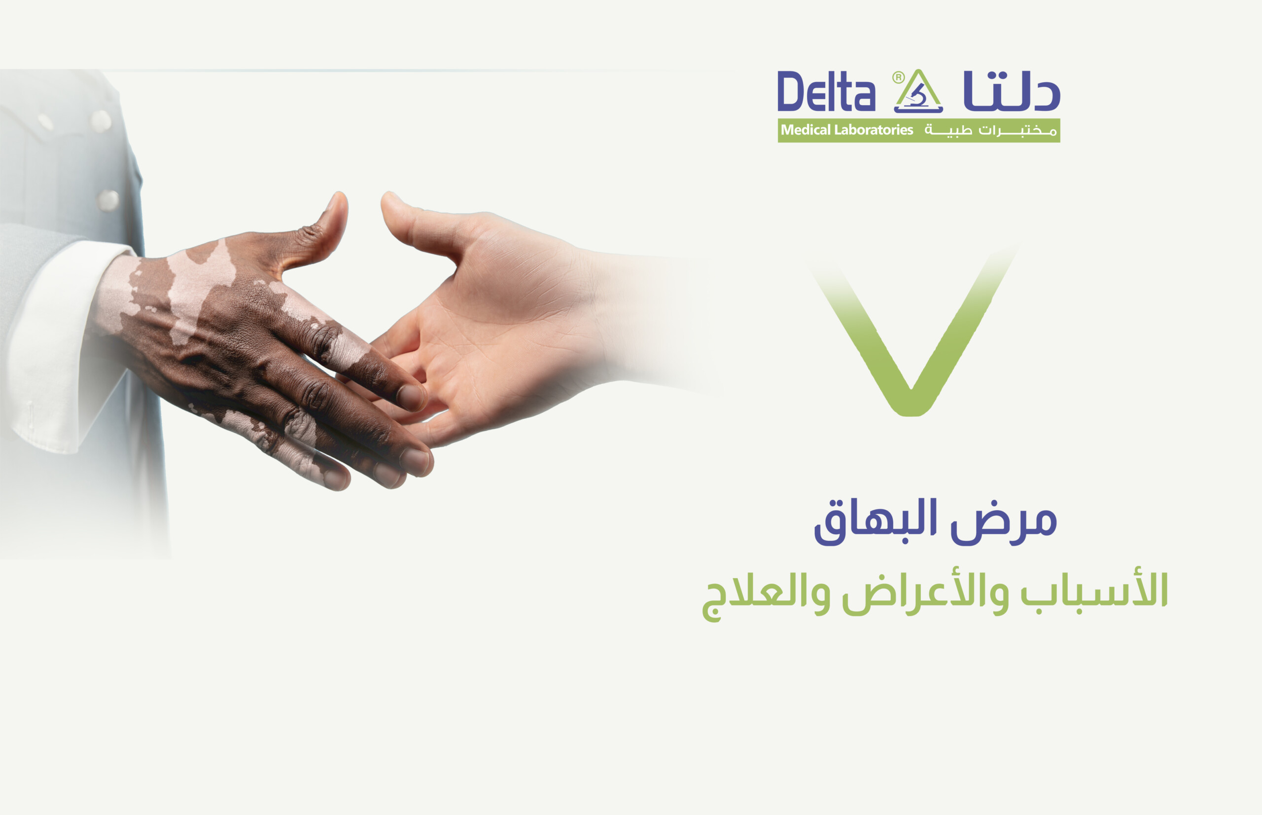 أسباب وعلاج مرض البهاق