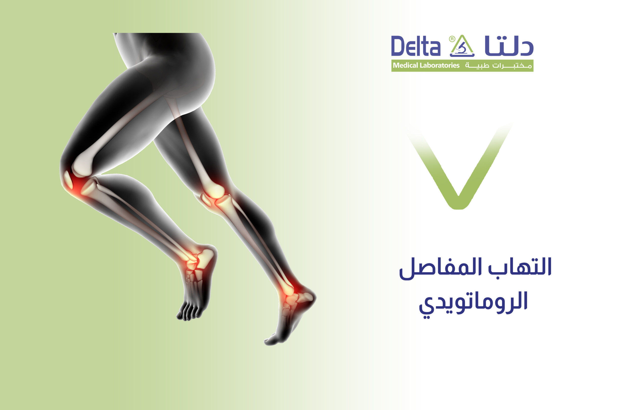 التهاب المفاصل الروماتويدي