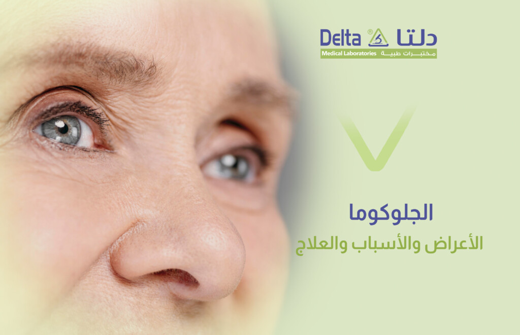 الجلوكوما