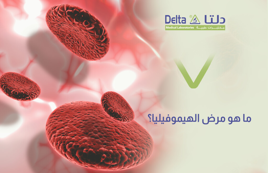 الهيموفيليا