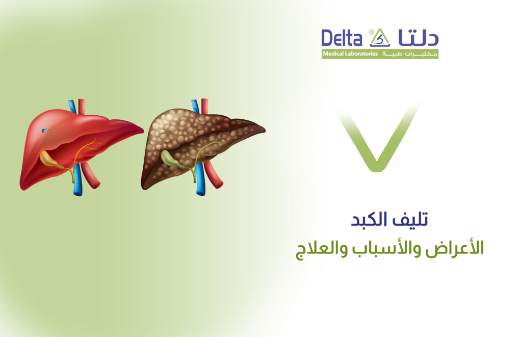 ما هو تليف الكبد وما هي أعراضه وأسبابه وعلاجه