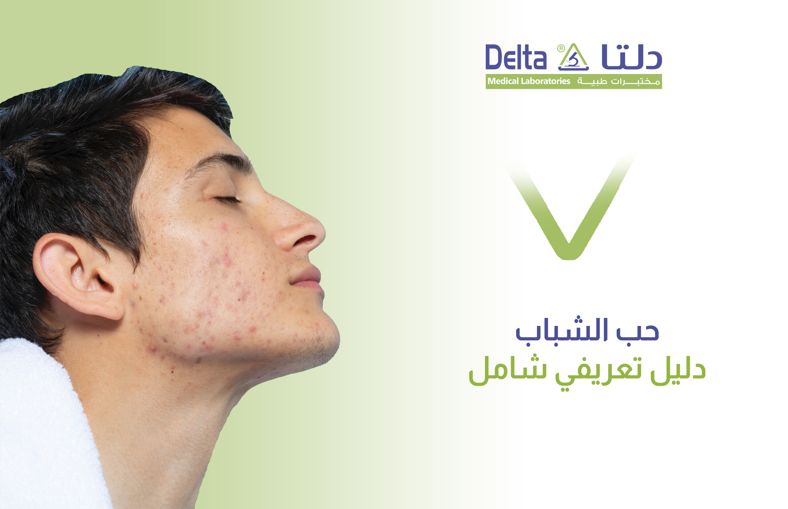 حب الشباب دليل تعريفي شامل