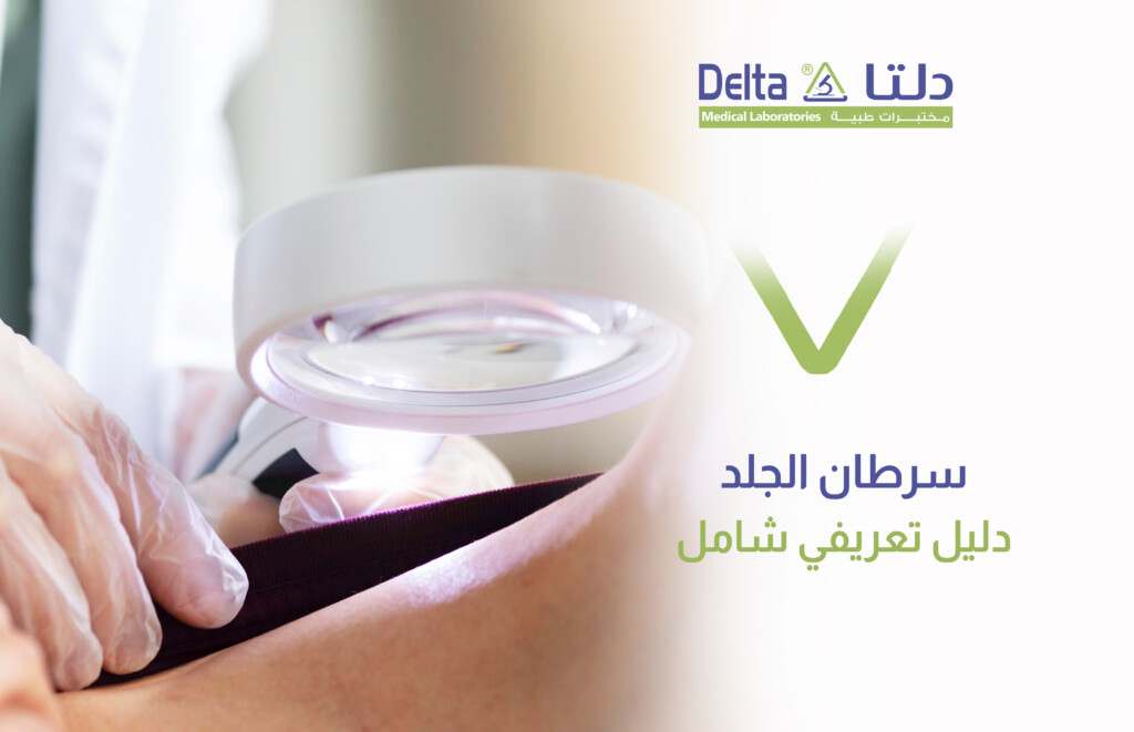 سرطان الجلد