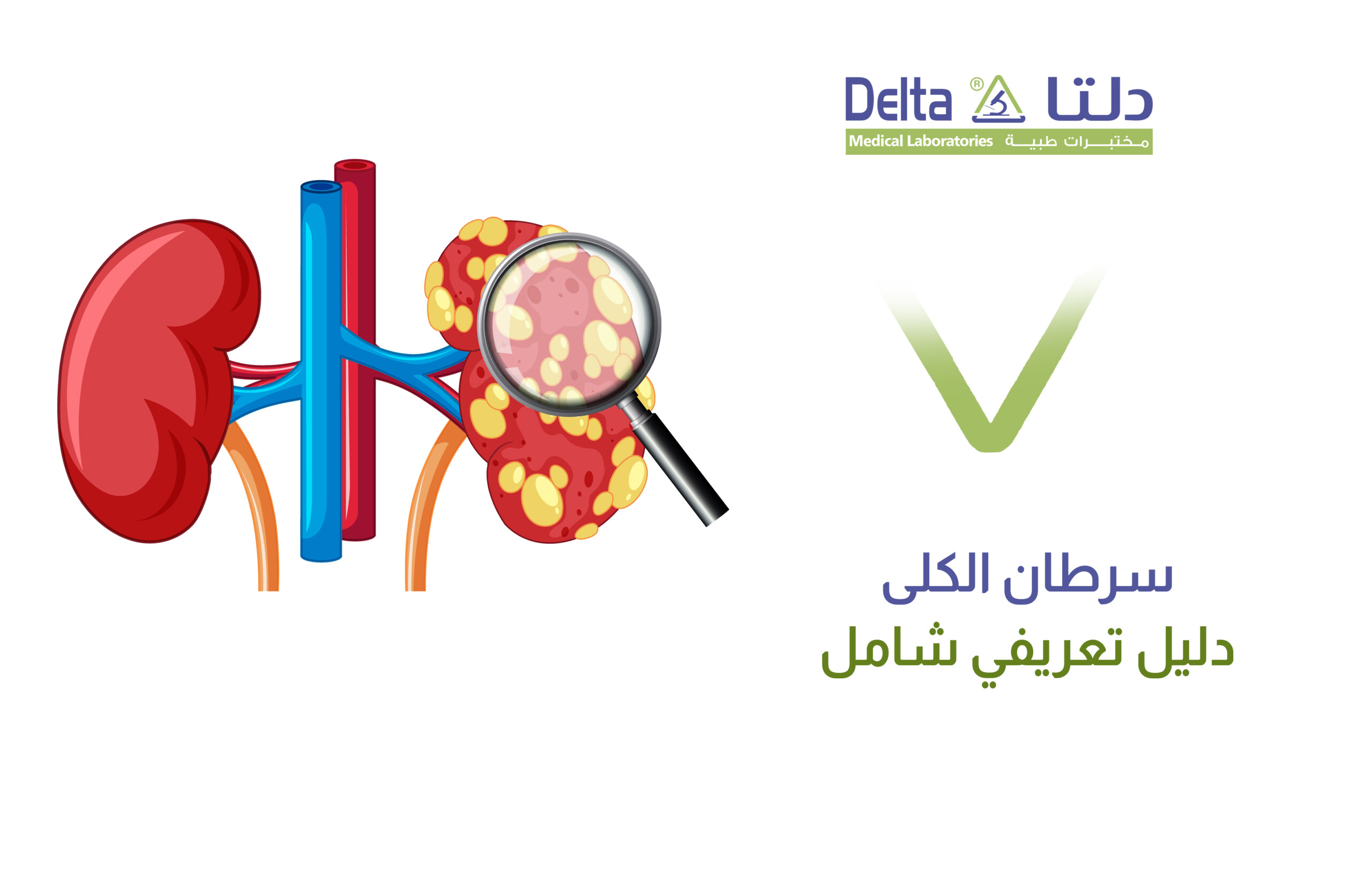 سرطان الكلى