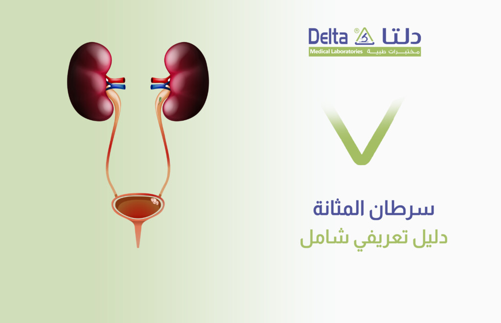 سرطان المثانة