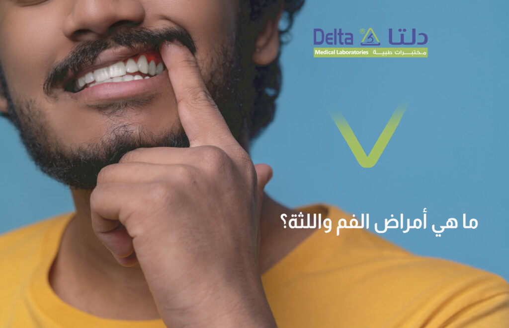 ما هي أمراض الفم واللثة