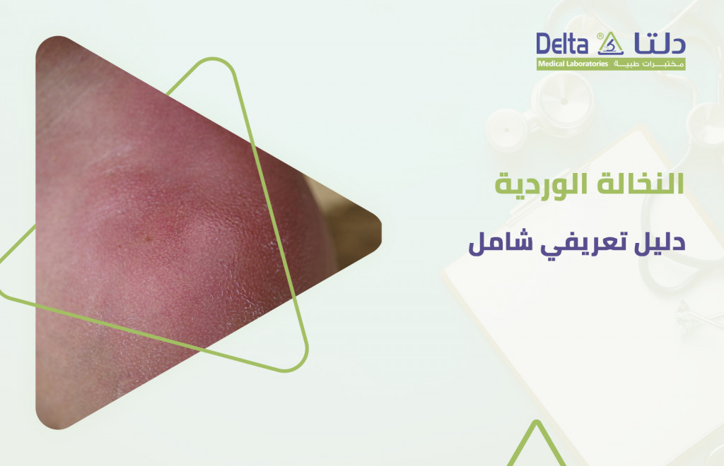 ما هو مرض النخالة الوردية؟