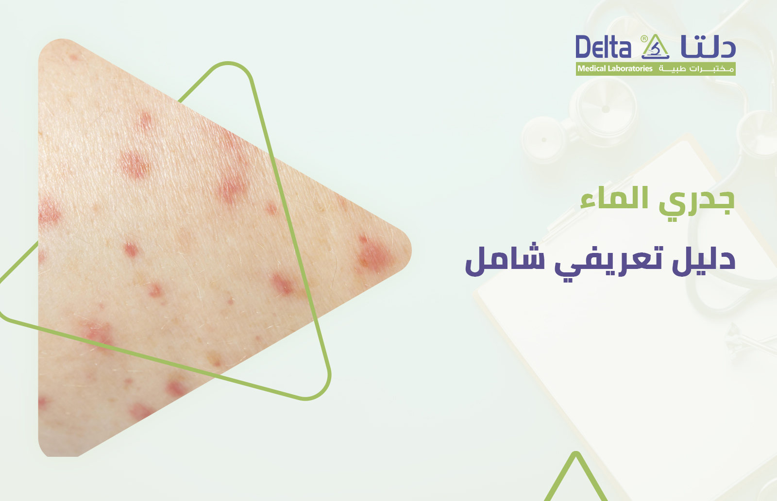 أعراض وأسباب وعلاج جدري الماء عند الأطفال والبالغين