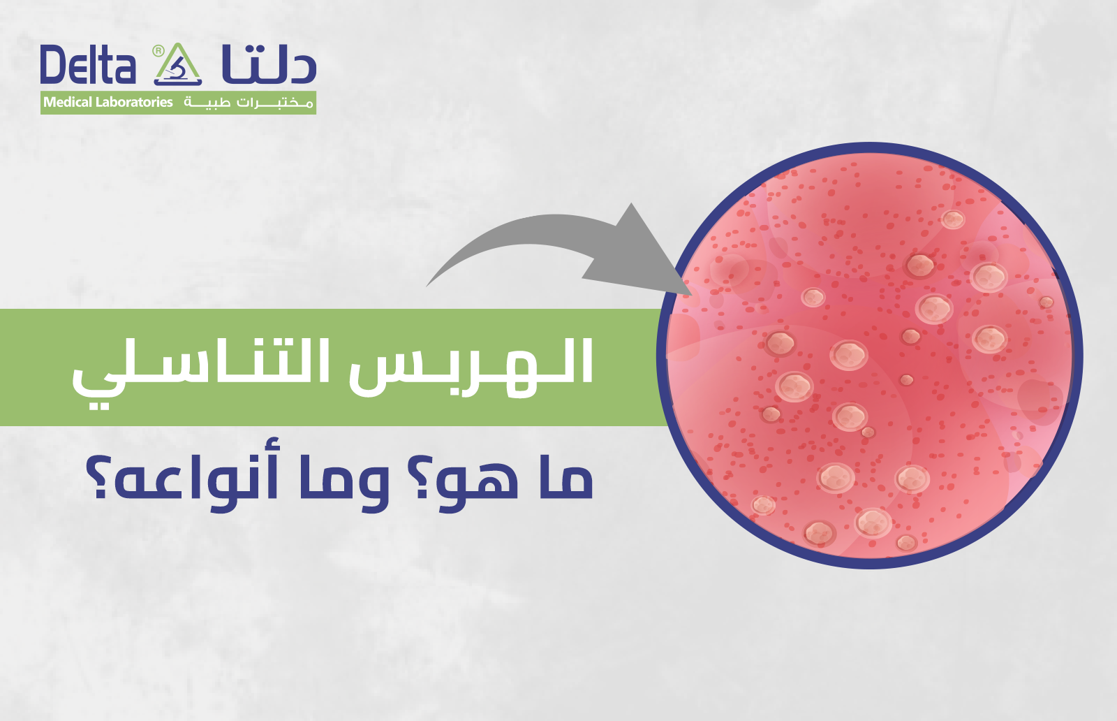الهربس التناسلي: ما هو؟ وما أنواعه؟ وأهم 5 طرق لعلاجه