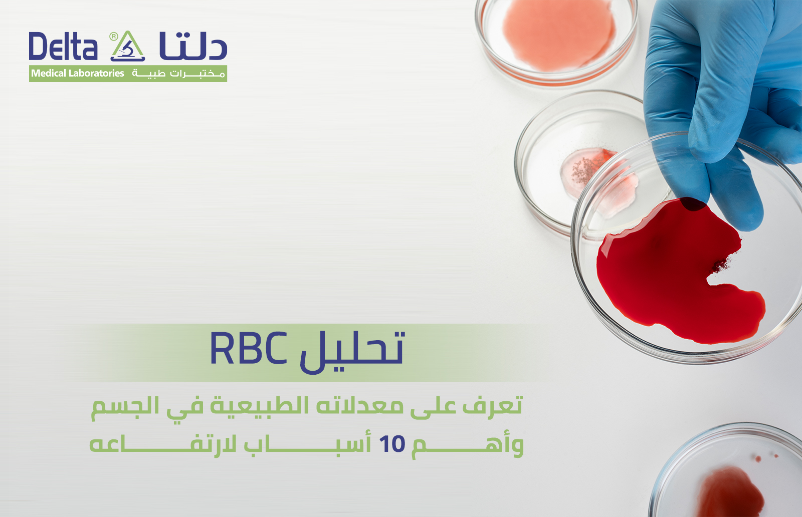 تحليل rbc تعرف على معدلاته الطبيعية في الجسم، وأهم 10 أسباب لارتفاعه