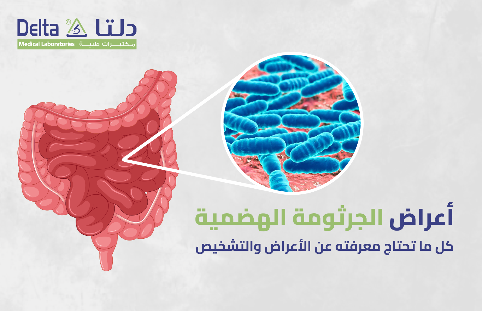 أعراض الجرثومة الهضمية: كل ما تحتاج معرفته عن الأعراض والتشخيص