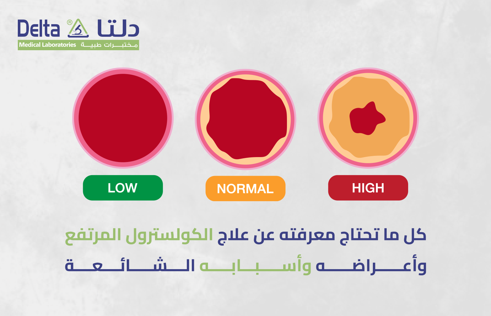 كل ما تحتاج معرفته عن علاج الكولسترول المرتفع وأعراضه وأسبابه الشائعة