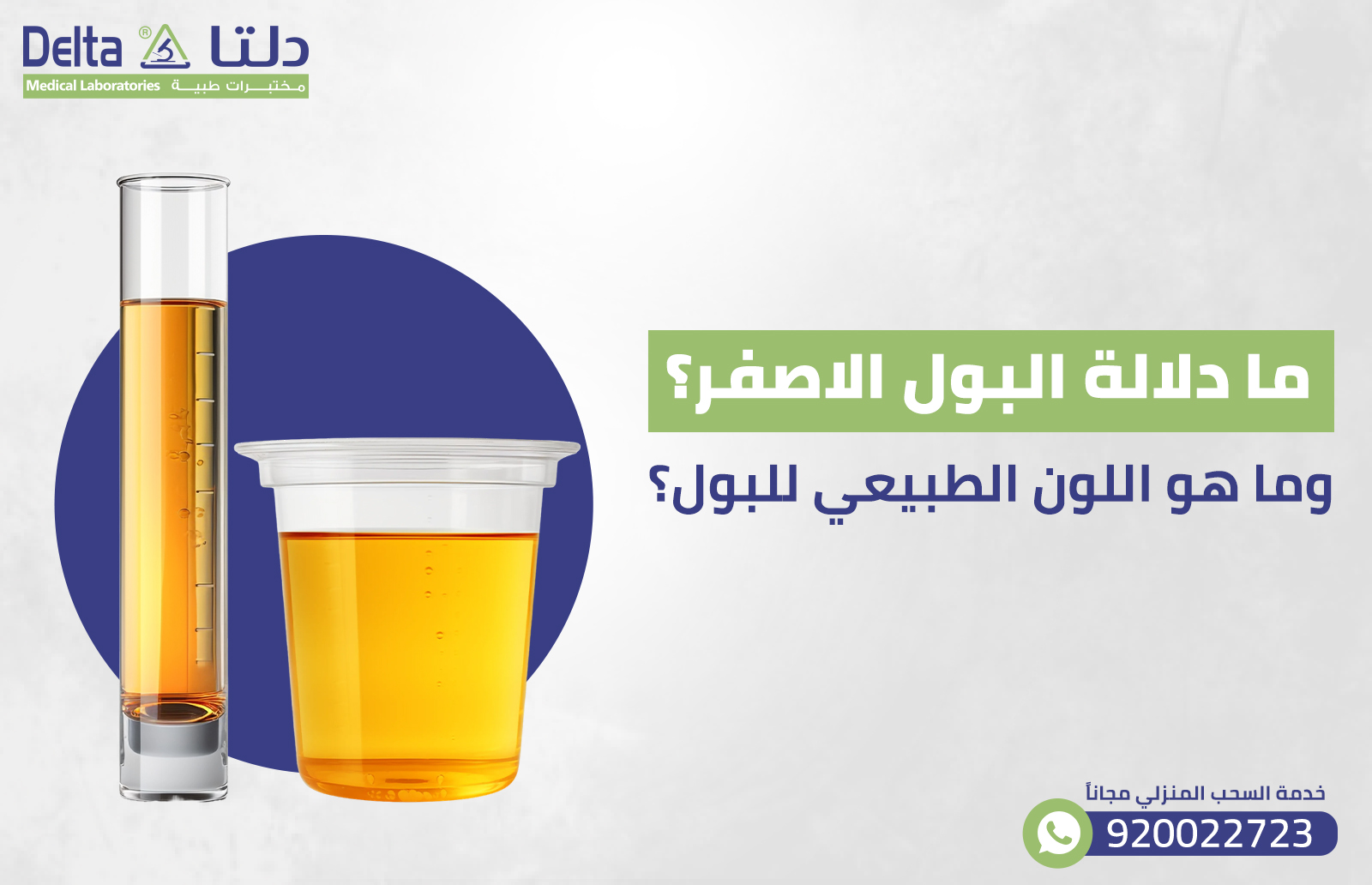 ما دلالة البول الاصفر؟ وما هو اللون الطبيعي للبول؟