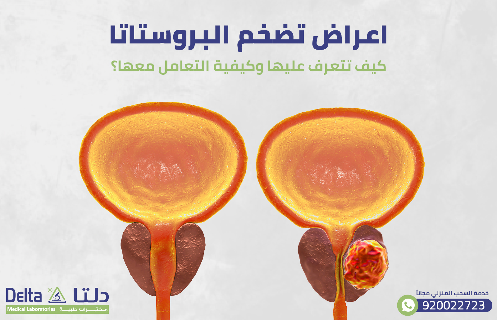 اعراض تضخم البروستاتا: كيف تتعرف عليها وكيفية التعامل معها؟