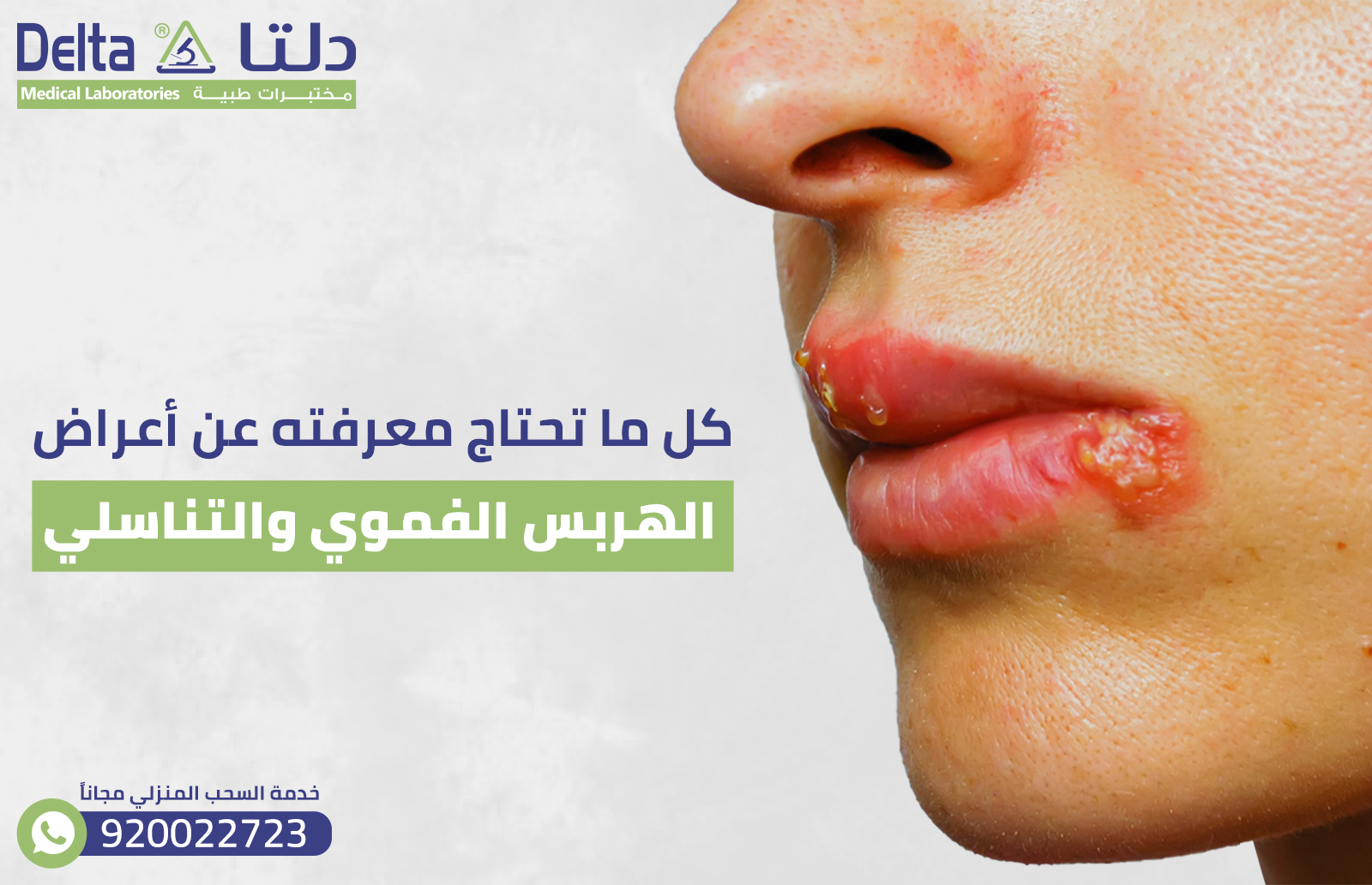 كل ما تحتاج معرفته عن أعراض الهربس الفموي والتناسلي