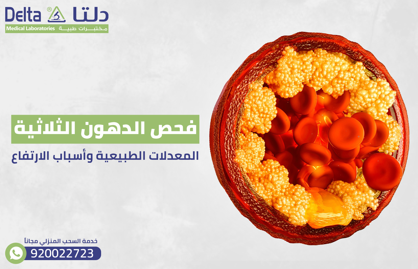 ‏فحص الدهون الثلاثية: المعادلات الطبيعية وأسباب الارتفاع