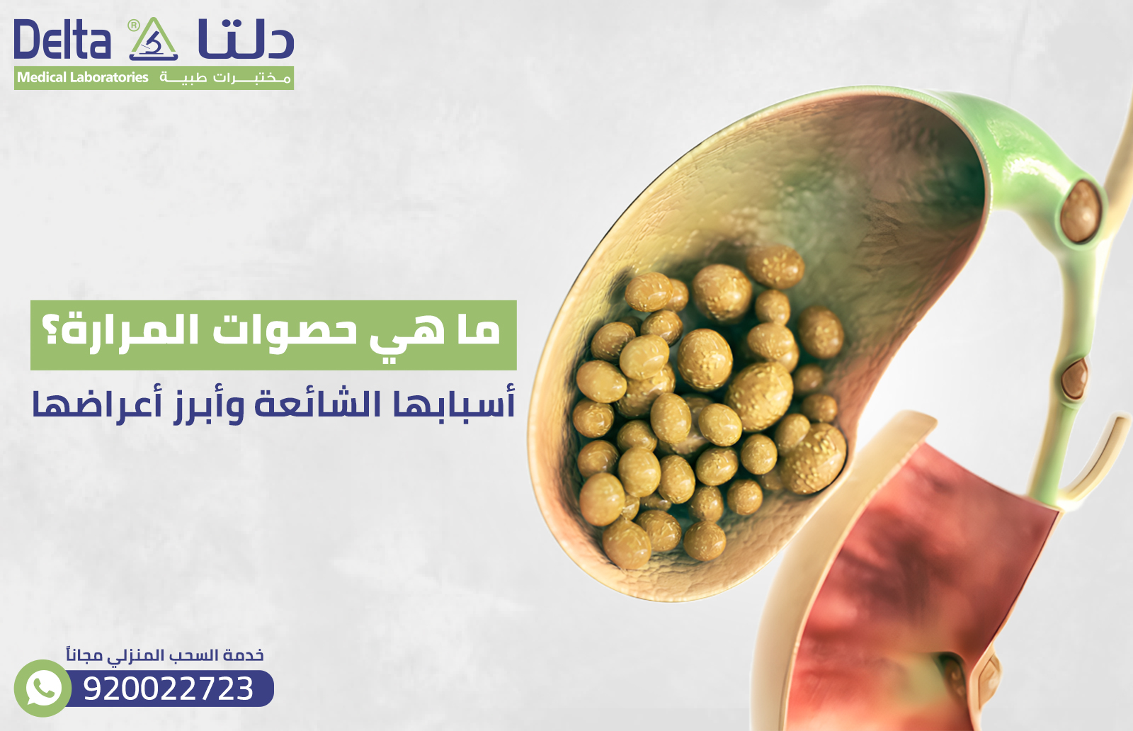 ما هي حصوات المرارة ؟ أسبابها الشائعة وأبرز أعراضها