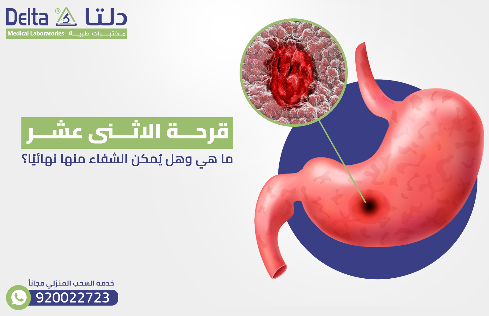 قرحة الاثنى عشر : ما هي وهل يُمكن الشفاء منها نهائيًا؟