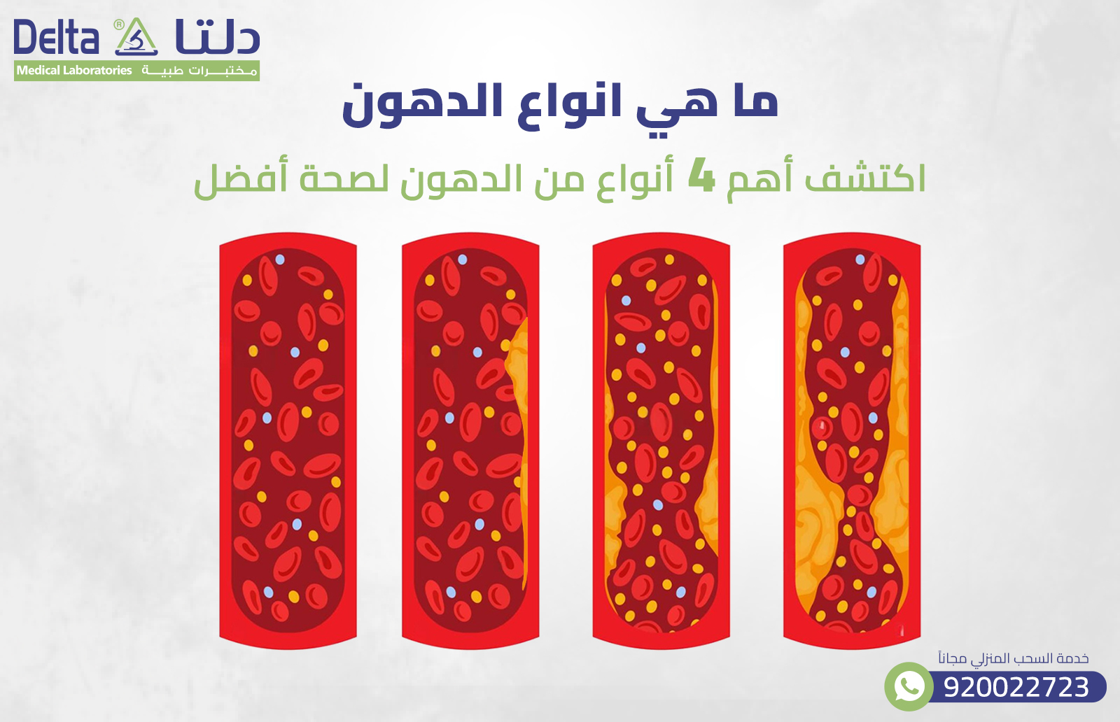 ما هي انواع الدهون: اكتشف أهم 4 أنواع من الدهون لصحة أفضل