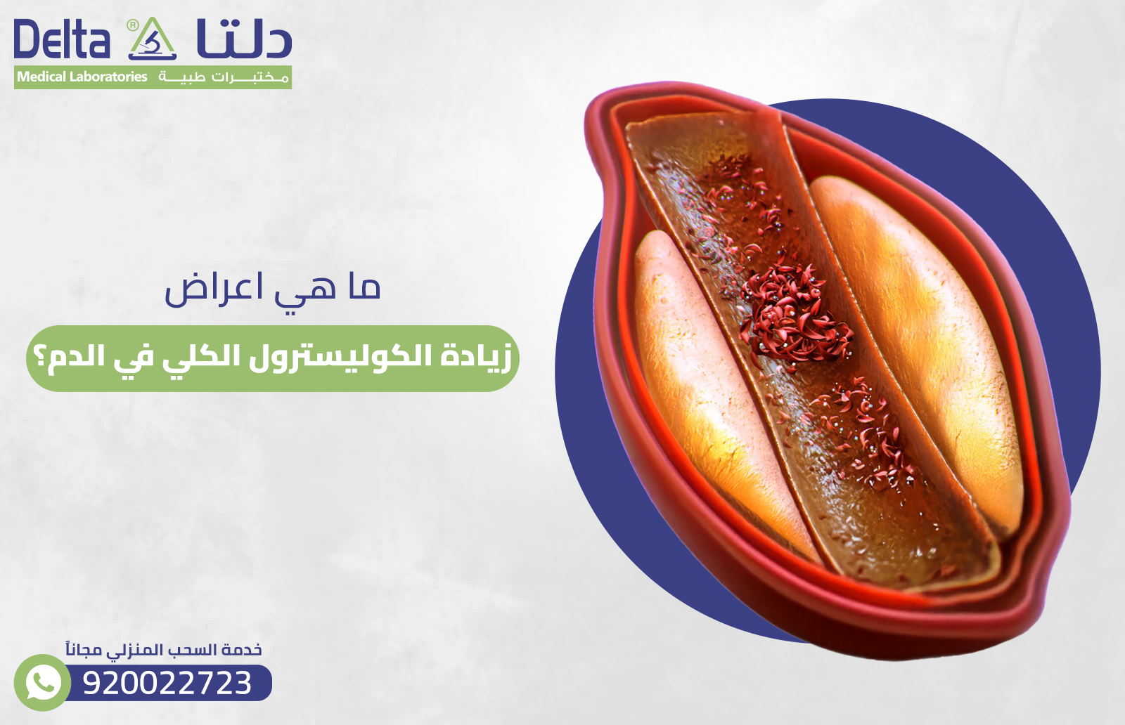 ما هي اعراض زيادة الكوليسترول الكلي في الدم؟