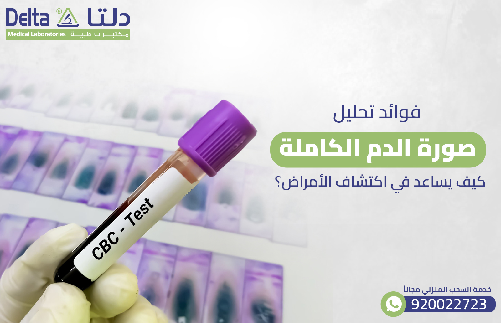 فوائد تحليل صورة الدم الكاملة: كيف يساعد في اكتشاف الأمراض؟ 