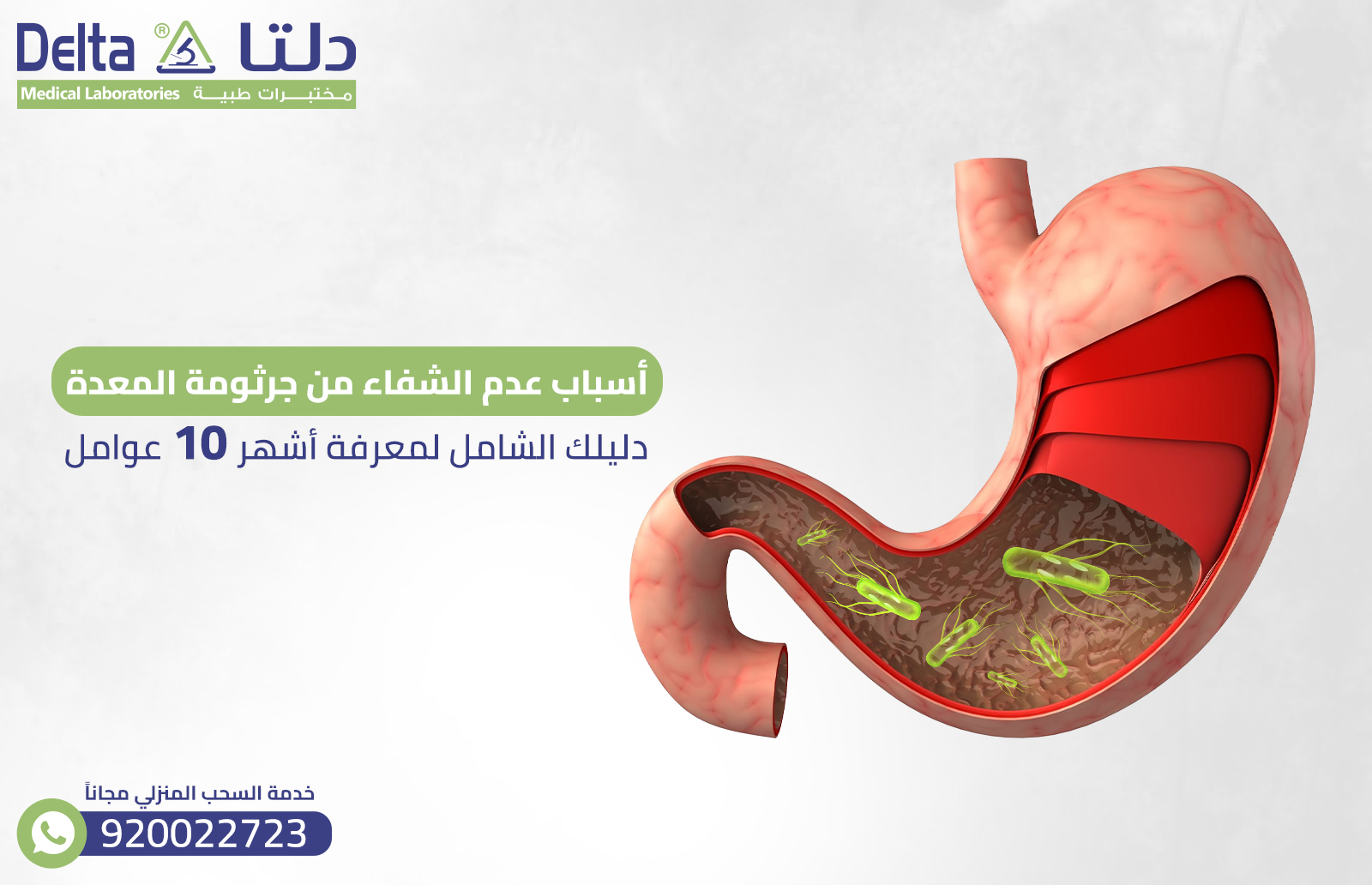 أسباب عدم الشفاء من جرثومة المعدة: لمعرفة أشهر 10 عوامل