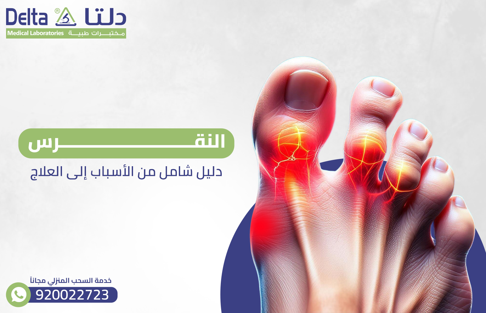 النقرس: دليل شامل من الأسباب إلى العلاج