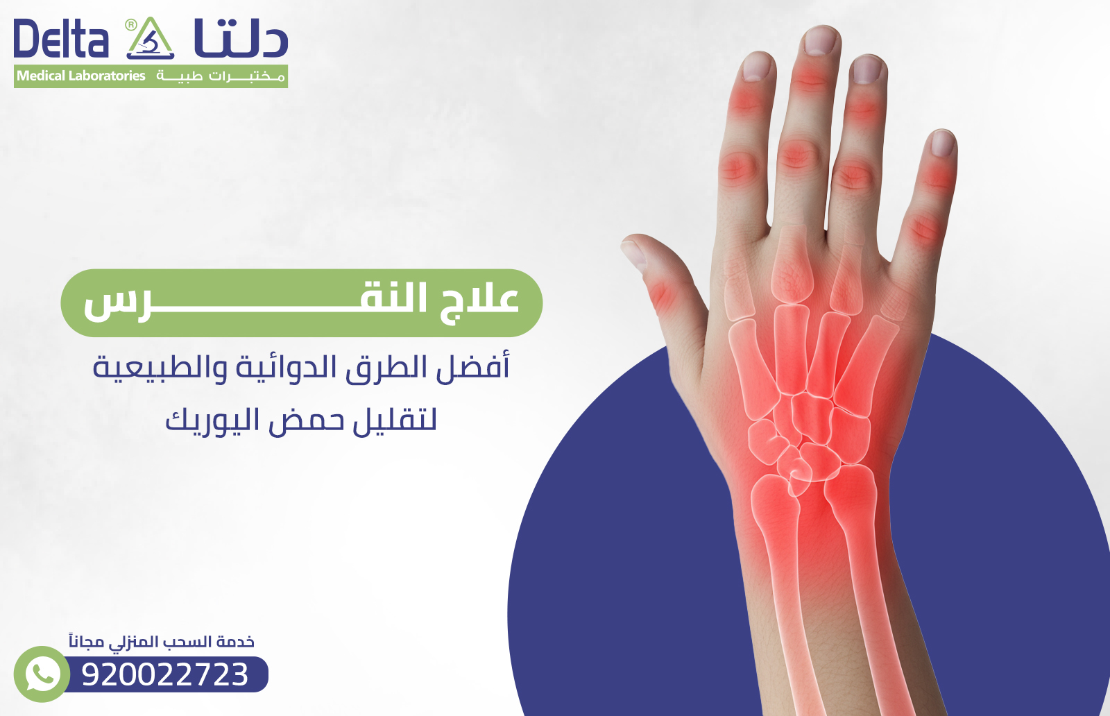 علاج النقرس