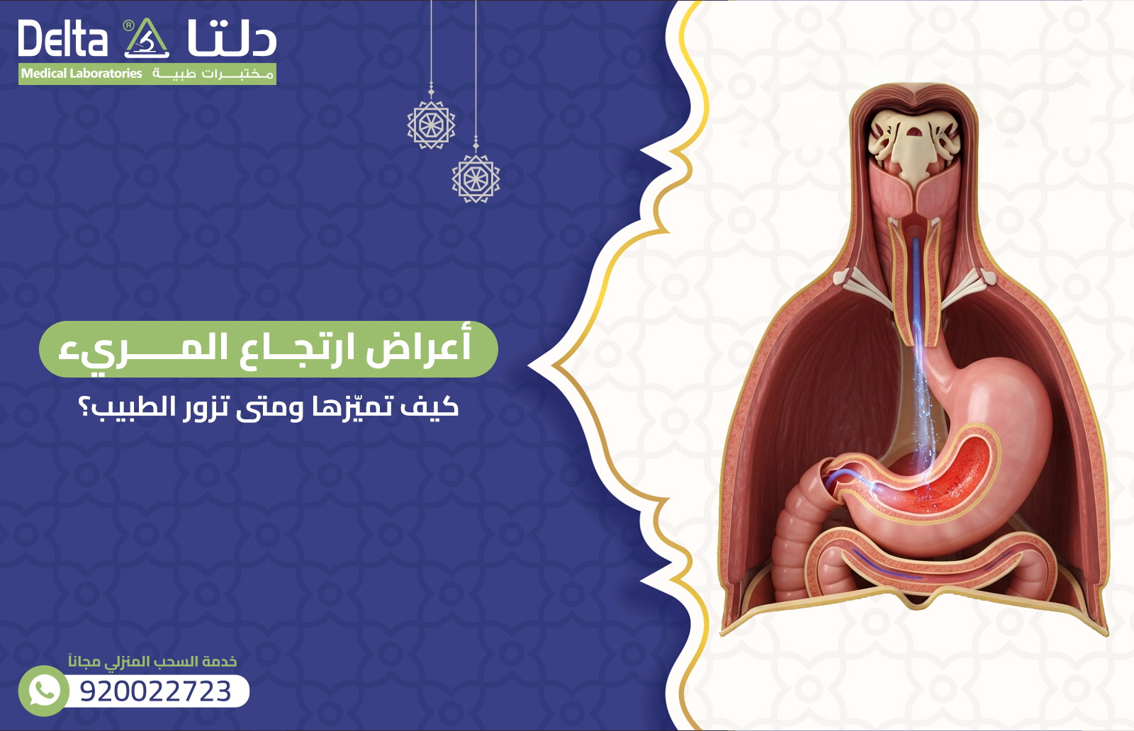 أعراض ارتجاع المريء: كيف تميّزها ومتى تزور الطبيب؟