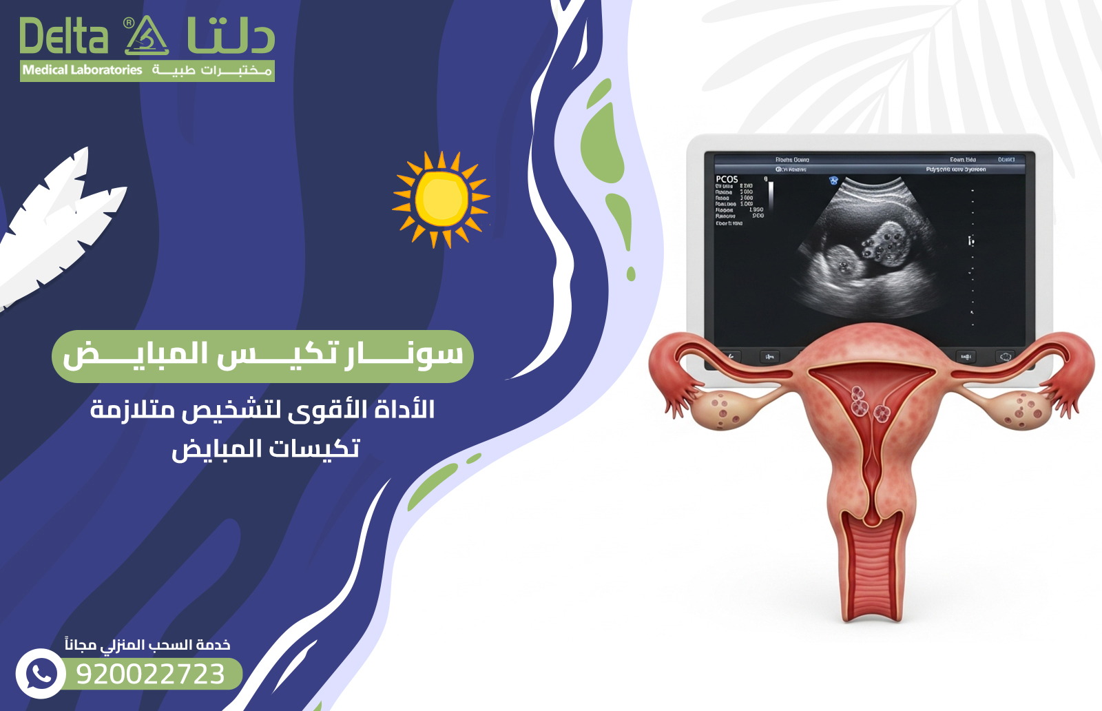 سونار تكيس المبايض