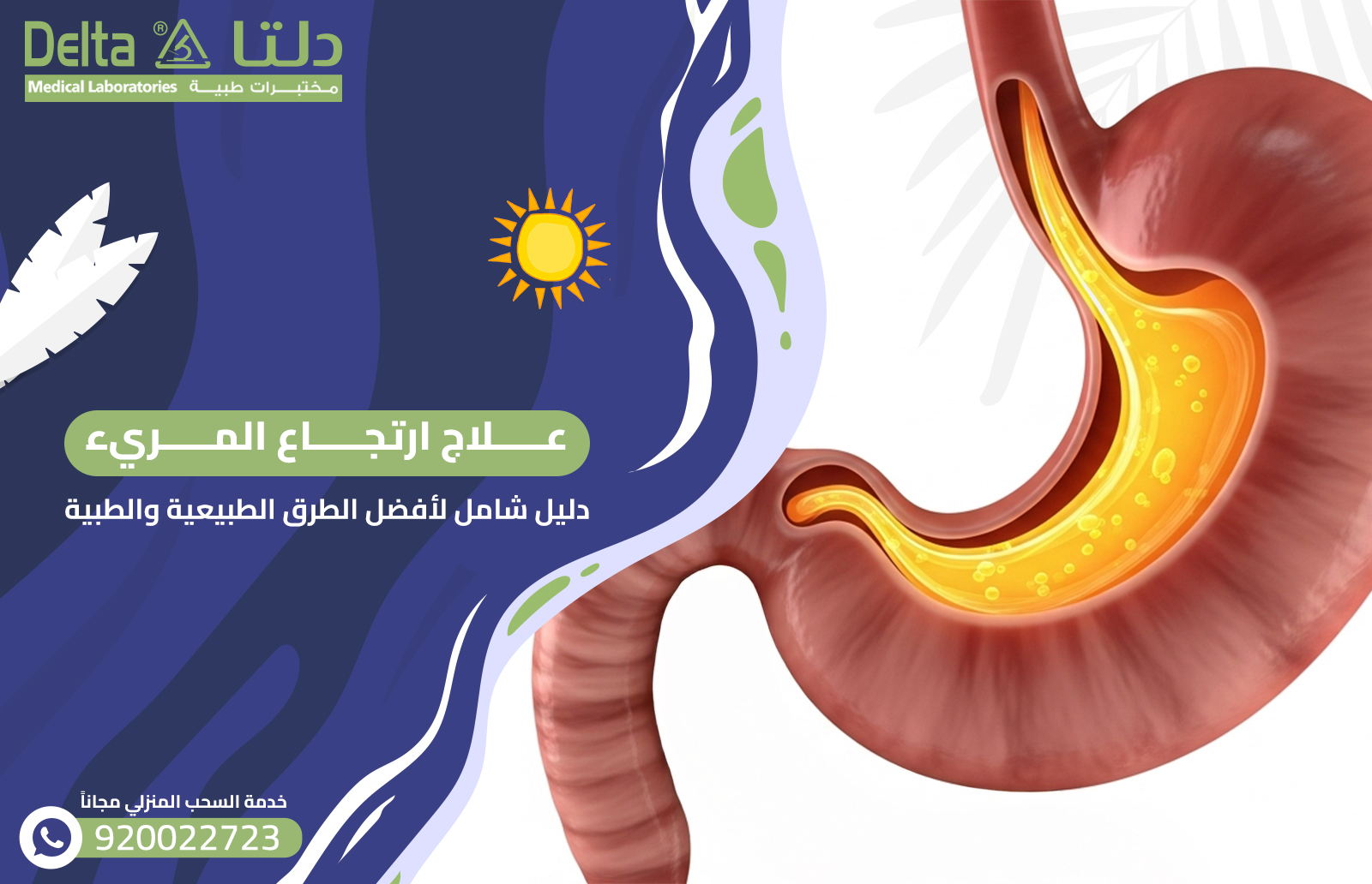 علاج ارتجاع المريء