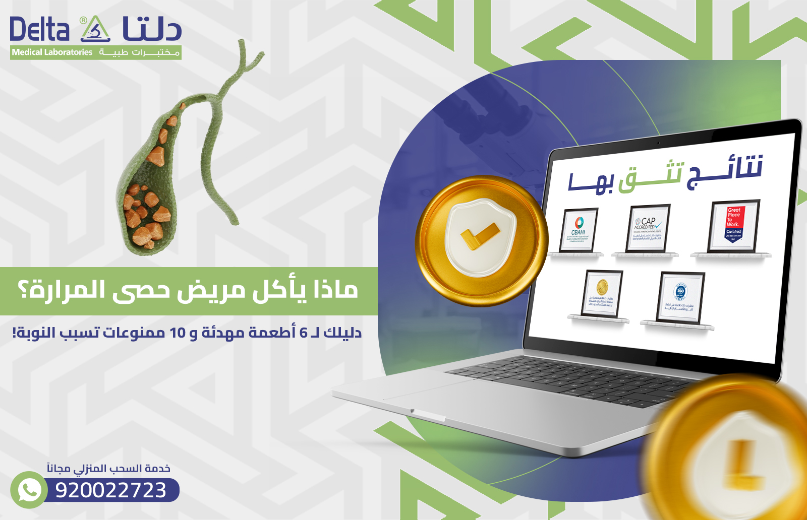 حصى المرارة